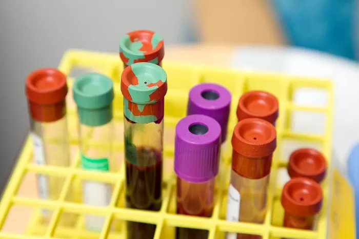 Mengegerkan Dunia Kedokteran! Ditemukan Kasus Langka Penemuan Golongan Darah Subtipe Baru di China